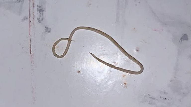 Vaasalaisperheen kananmunasta löytyi 8-senttinen suolinkainen. Kuvassa suolinkainen perheen pöydällä.