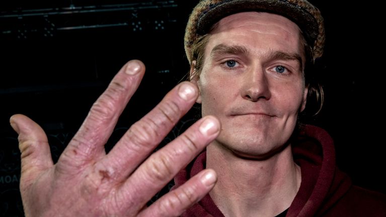 Oululainen, 35-vuotias Teemu Kalliojärvi kertoo, miten kehopositiivisuus on muuttanut hänen elämäänsä ja miten hän entisenä kilpaurheilijana on kehoonsa suhtautunut ja suhtautuu.