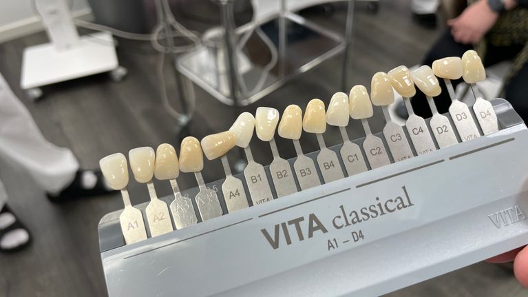 Hammasimplanttien "värikartta" jonka avulla tulevan implantin väriä määritellään etukäteen.