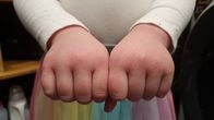 Lapsen kuivat kädet nyrkissä ojennettuna eteenpäin lähikuvassa.