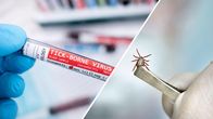 Bildcollage. Till vänster syns ett blodprov för TBE-virus, till höger en hand som håller i en fästing med en pincett.