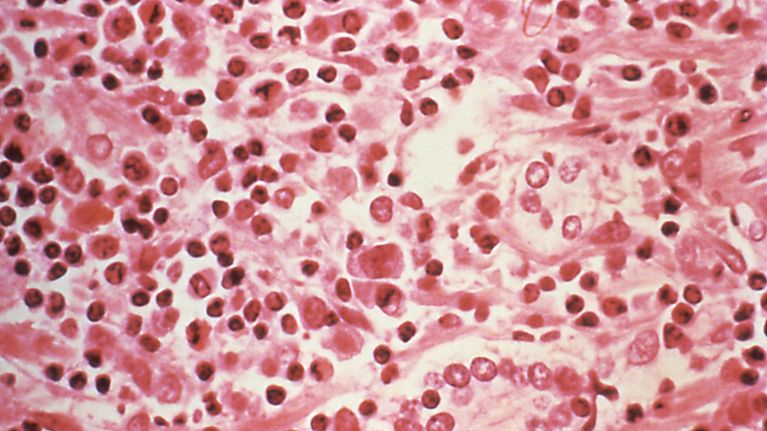 tappava-epidemia-puhkesi-viikkoja-ennen-sen-toteamista-n-in