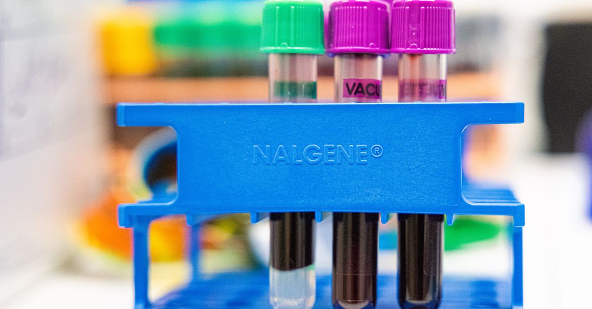 Tavallinen kolesterolitesti ei kerro koko totuutta: joka kol