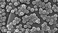 Mustavalkoinen mikroskooppikuva MRSA-bakteerista