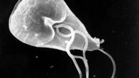 Pyyhkäisyelektronimikroskooppikuva Giardia lamblia -loisesta. Millimetrin sadasosan pituinen, yksisoluinen eläin liikkuu kuvassa näkyvien siimojen avulla. 