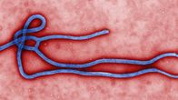Ebola-virus.