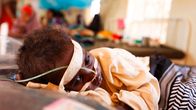 Aliravittu somalialaislapsi hoidettavana pakolaisleirin klinikalla.