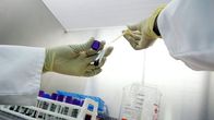 Verinäyte laboratoriossa.