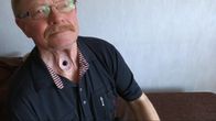 Ossi Haajasen kaulassa on avanne, joonka kautta mies hengittää.