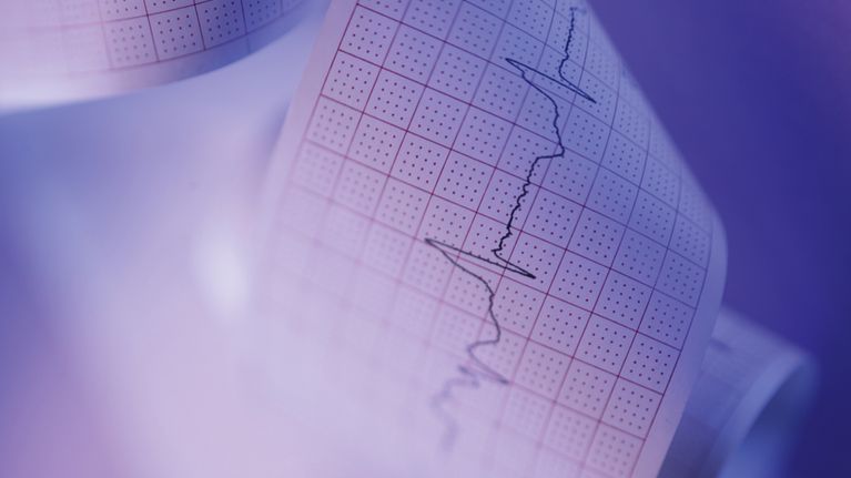 Sydämen toimintaa kuvaava EKG-käyrää paperilla.