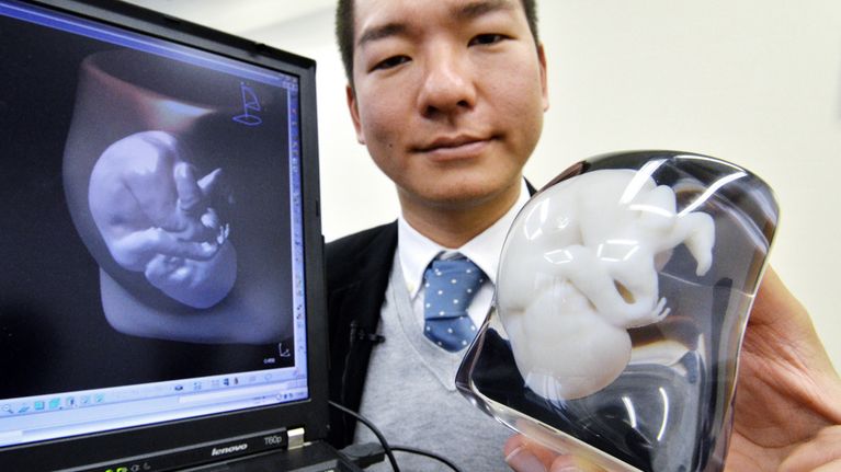 Fasotec-yhtiön edustaja esittelee sikiöstä tehtyä 3D-mallia.