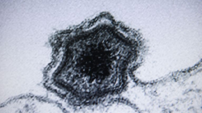 Sikaruttovirus mikroskooppikuvassa.
