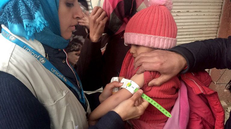 UNICEFin työntekijä mittaa aliravitun lapsen käsivartta Madayan kylässä.